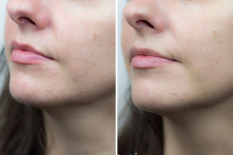 CC crème Red Correct d�Erborian Avis et swatchs avant/aprés